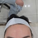 썬메디컬 | 곳 대구티리온X기기관리 리프팅탄력관리에좋은 온다리프팅 대구메디컬스킨케어에스테틱 "아미뷰티센터"