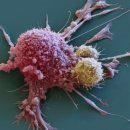 암세포에 숨어 들어가 죽이는 '암살자' 항암 치료법 나왔다 이미지