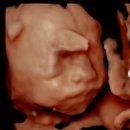 [임신이야기] 21주~25주 임신중기 증상 및 입체초음파 임당검사 후기