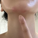 감마에너지 | 햇살이네마을 블랙커런트 감마리놀렌산, 은행잎추출물까지 더한 혈행개선영양제 추천