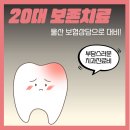 2020-03-0319 | 울산 보험상담, 20대 치아보험 보존치료 중심으로!
