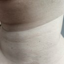 성지한의원 | 대구편평사마귀제거 대구쥐젖제거무제한 유툽300만조회수 성지 한의원 내돈내산 후기