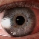 아이메디케어 이미지