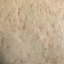 마이 클라랑스 포어-레스 블러 앤드 매트 스틱 모공지우개 클라란스