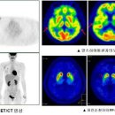 PET/CT 검사-아주대학교병원 핵의학과 이미지