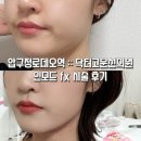 닥터고운선의원 | 압구정 닥터고운선의원 인모드fx 리프팅 1회 변화 후기