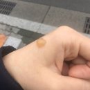 부강외과의원 | 월배역 화상병원 부강외과의원 후기