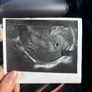 연산제일의원 | 임신 5주 4일차 아기집들이 성공👼🏻 | 임신확인서, 국민행복카드, 임산부KTX할인 신청방법