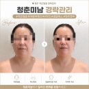 미남시대 | 청주경락 얼굴관리받고 이중턱 라인 달라진 청춘미남 후기