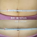 출산하고 나서 106.9kg.. 마사지 4회 받고 재보니 99.8kg이네요. 배 둘레가 7cm 나 줄었어요 이미지