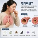 [천식 증가 추세] 이미지