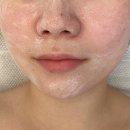 길훈(아) | 의정부에스테틱 시그니쳐 작은얼굴 윤곽관리 하고 왔어요
