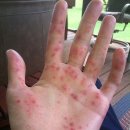 수두농장 이미지