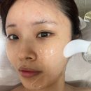 대구 피부관리 추천! 이엘뷰티 하이푸 물방울리프팅 후기