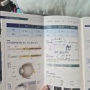 눈에손안과의원 | 25년 9월에 한 컨투라 라섹 9개월 후기 (비스타안과)
