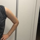 탑 클리닉 빌딩 | 유라인클리닉 지방분해주사 팔뚝컷주사 솔직후기! 컷주사 원조에서 군살 정리하고 온 날