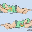 역류성 식도염 예방 자는 자세 이미지