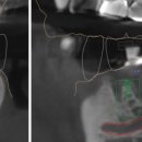 네이처치과기공소 이미지