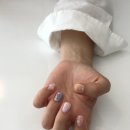 시소네일 이미지