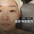 청주피부관리 약손명가 가경동점