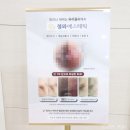 청와(아) | 미사 피부관리 청와에서 겨드랑이, 유륜 미백 바이뮬리 후기
