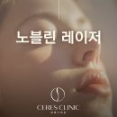 노블린레이저 후기, 홍조·기미 효과와 후관리까지 한 번에 정리