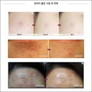 올레오사