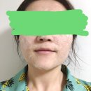에뜨레벨 | 찾았다 인생 쿨링팩! 에뜨레벨 무스팩 사용 후기!