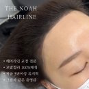 선헤어라인 이미지