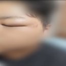 옷장애 이미지