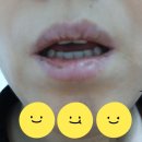 거제알로에팜 | 쇼그렌증후군 구강건조증 완화, 생알로에 베라 내돈내산 후기
