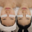 압구정-109 | [결혼준비] 압구정 스파유 | 압구정 에스테틱 | 압구정 웨딩케어 | 맞춤 예비 신부관리 후기