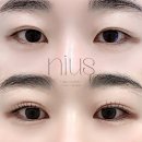 니어스 아이래쉬