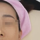 코코넛 피부샵 이미지