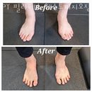 피지오짐 이미지