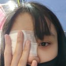 옥정튼튼약국 | 다래끼 짼 후기/ 다래끼 수술 후기/ 다래끼 안째는 법/ 회복방법