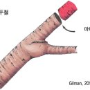 두절 / 3년 이상 나무 두절하면 활력 악화 이미지