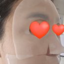 백옥슈퍼 | [아로셀] 기미 잡는 백옥 관리? 아로셀 멜라 TXA 마스크 12매 사용 후기 (ft. 미백 끝판왕)