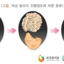 엠지에프두피탈모전문센터 이미지