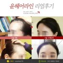 윤헤어라인 - 서구 | 윤헤어라인