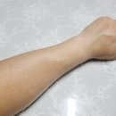 바른선 테라피 이미지