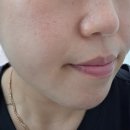부천로10번길 | [부천역 피부관리] 희윤뷰티｜물방울 아쿠아케어 받고 온 후기