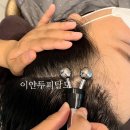 이안두피탈모 이미지