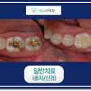 이스터치과의원 이미지