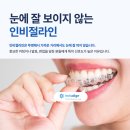 이앤와이교정치과기공소 | 신당역치과 인비절라인 특징·후기·비용 총정리! 투명교정 완벽 가이드