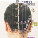대추(大椎)-GV14 이미지