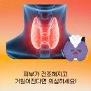 대구 서구 갑상선기능항진증 증상 단순 피로와 어떻게 다를까요?
