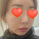 광녀스킨케어 | 맞춤관리전문인 부천에스테틱 디아르에스테틱에서 꿀광피부로 변신한 후기