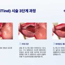 선메디칼 이미지