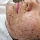 태평양프라자 | [뷰티포톤피아] 부천상동점ㅣ반복되는 성인 트러블 해결사! 상동 여드름관리 꼼꼼한 피지 정돈 후기